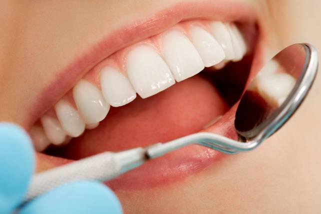 Blanqueamiento dental Bogotá revisión