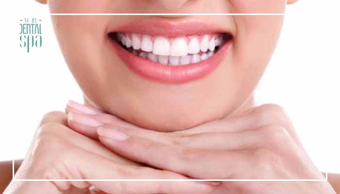 Alimentos que te ayudarán a mantener tu blanqueamiento dental