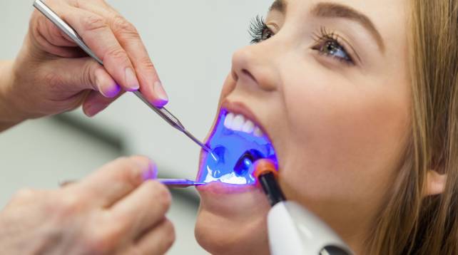 En qué casos se aplica el uso de implantes dentales