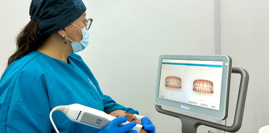 Tecnonogia 14-85 Dental Spa itero scanner paciente